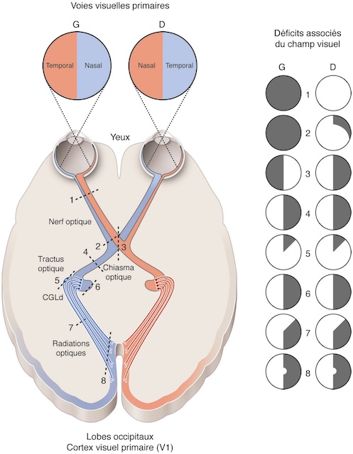 Trajet complet des voies visuelles et types de déficits visuels associés selon la localisation de la lésion sur le circuit rétino-géniculo-cortical.