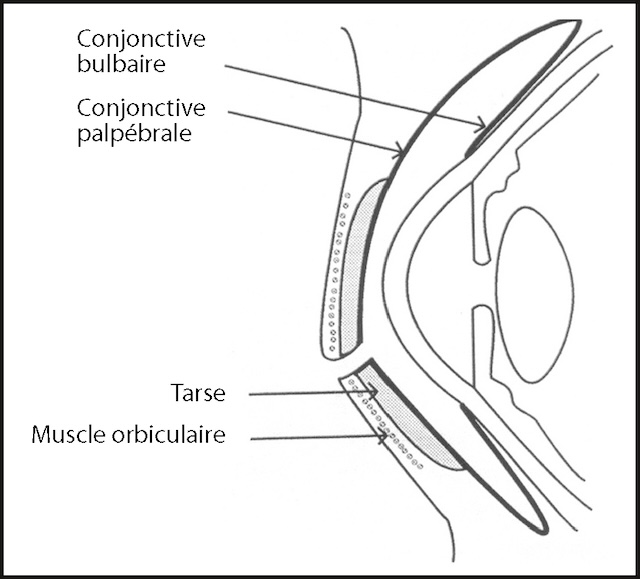Coupe détaillée illustrant la conjonctive et les paupières, révélant leur rôle clé dans la protection de l’œil.
