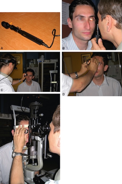 Différentes techniques d’examen du fond d’œil : ophtalmoscope direct, indirect et lampe à fente en contexte clinique. Examen réalisé avec lumière projetée à travers la pupille.