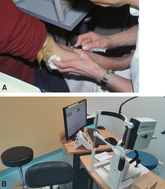 Injection du colorant suivie d’un examen du fond d’œil par une caméra spécialisée dans une procédure d’angiographie rétinienne.