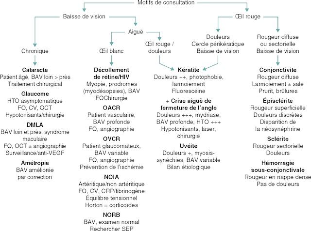 Algorithme visuel aidant à identifier les causes d’une baisse de vision ou d’un œil rouge selon l’aspect clinique et les symptômes associés.