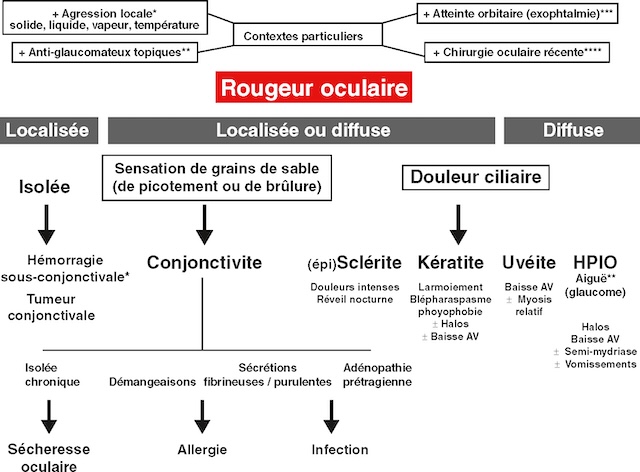 Une carte visuelle simple pour comprendre comment explorer la cause d’un œil rouge, entre rougeur bénigne et pathologie plus grave.