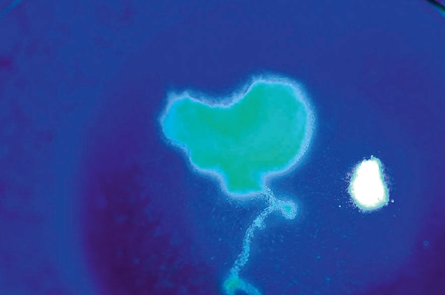 Ulcération cornéenne en carte géographique avec branchement dendritique, typique d’une kératite herpétique active.