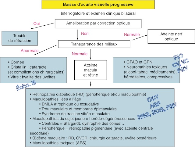 Organigramme décrivant la prise en charge clinique d’une baisse progressive de l’acuité visuelle.