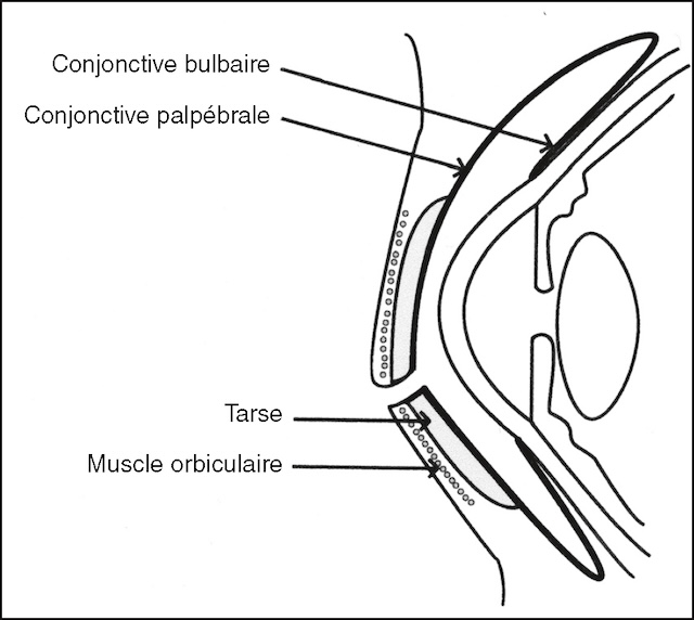 Schéma en coupe verticale montrant les structures des paupières et du globe oculaire, incluant conjonctive, tarse et muscle orbiculaire.