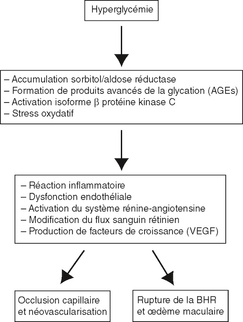 L’hyperglycémie entraîne inflammation, VEGF et fuite vasculaire, menant à néovaisseaux ou œdème maculaire.